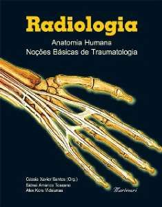 RADIOLOGIA - ANATOMIA HUMANA NOÇÕES BÁSICAS DE TRAUMATOLOGIA